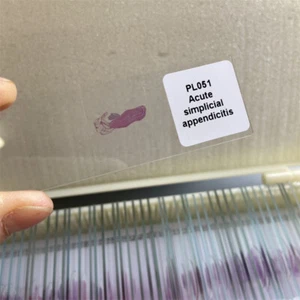 100 PCS Menschlicher pathologischer Schnitt Typische präparierte Gewebeprobenrut - Bild 1 von 12