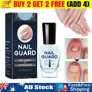 Onyxoguard Nail Growth and Repair Serum, Onyxoguard Nail Growth & Strengthener - Picture 1 of 12