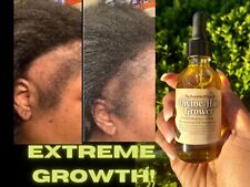 FAST HAIR GROWTH Organic Growth Oil  Balding Thin Edges Alopecia Chebe Miracle 