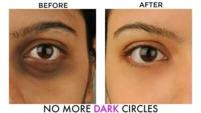 Bye Bye Dark Circles, Under Eye Cream for Dark Circles, with Cucumber 20g - Image 1 of 4