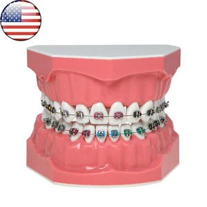 Dental 1:1 Teeth Model Typodont Orthodontic with Metal Brackets Braces M7010-2 - Picture 1 of 16