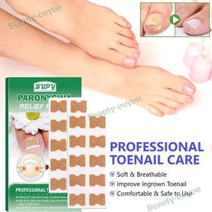 50Pcs Dann Nagel Behandlung 8 Hours Effective Nail Paronychien Reparatur Patches - Bild 1 von 11