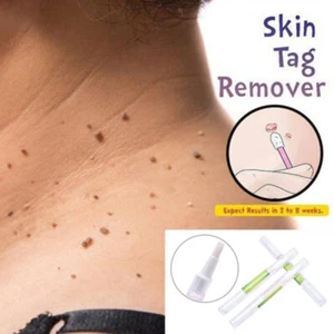 3ml Removal of Warts Liquid From Skin Tags Removing Against Wart Corn Remove - Bild 1 von 12