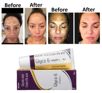 GLYCO 6 GLYCOLIC ACID CREAM 6% (30GMS) + FS - Image 1 of 4