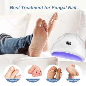 Repair Fast Nails Fungus Repair Toenail Fingernail Removes Nail Fungus Foot Care - Picture 1 of 19