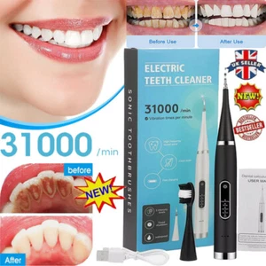Dental Tooth Cleaner Powerful Ultrasonic Plaque Remover for Teeth with 5 Modes - Picture 1 of 18