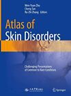 Atlas Of Skin Disorders Challenging Presentations Of Common To