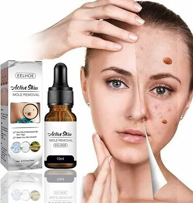 1/2pcs Mole Wart Remove Skin Face Armpit Flesh Tags Remove Collagen Peptides - Image 1 of 4