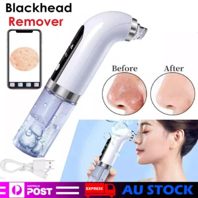 Electric Blackhead Remover Vacuum Pore Face Facial Suction Acne Cleaner Kit NEW - image 1 of 4
