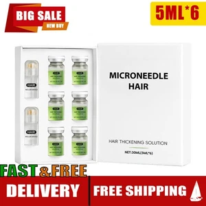 Hair Regrowth System%2CAdvanced Hair Growth Treatment Ginseng UK *7 - Picture 1 of 19