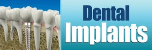 2ft x 6ft Dental Implants (th) Vinyl Banner 2'x6' -Alt to Banner Flag (220) - Picture 1 of 1