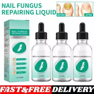 Kerassentials per Unghie Funghi Kerassentials Olio Trattamento Funghi Unghie Nuovo - Foto 1 di 14