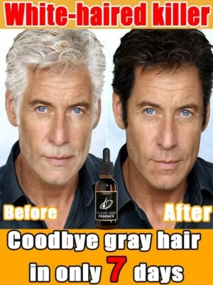 NEW Hair Growth Boost White hair Killer Natural Color 7 days Reduce Hair Loss - Image 1 of 4