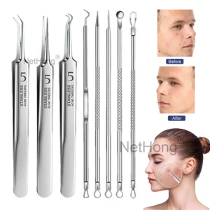 Acne Needle Blackhead Remover Pimple Blemish Comedone Extractor Tweezer Kit Tool - Picture 1 of 19