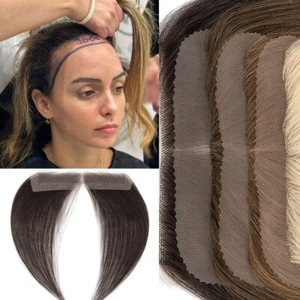Receding Hairline Full Lace Cover Up Remy Human Hair Patches Pieces Women Topper - Picture 1 of 11