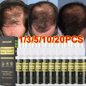 1-20 Monats-Vorrat Extra Stärke MINOXIDIL 5% Spray Haarwachstum FÜR MÄNNER 60ML - Bild 1 von 22