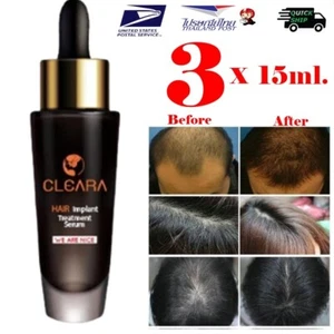 3 x 15ml. Authentic Cleara Hair Implant Treatment Serum Reduces Hair Loss +Track - Picture 1 of 11