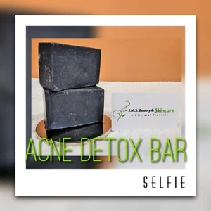 Handmade 100% Natural Activated Charcoal Detox Soap. 5ounce bars - Picture 1 of 1