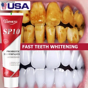 Sp 10 Pasta Dental Sp-8 Ultra Whitening Sp10 Probiotic Toothpaste - Picture 1 of 12