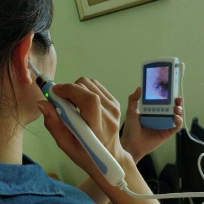 Mira telescópica LCD de 3 pulgadas con cavidad oral de garganta otoscopio TV cámara de inspección de video Foto 1 de 4