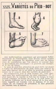 Cpa Series Alcoholism Drawings C. Houlbert Edit Mazo Xxix Circa 1911 - Picture 1 of 2