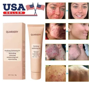 3Pack Gel Esfoliante Quarxery - Detergente Multiuso - Formula Delicata 50g 1,76 oz - Foto 1 di 16