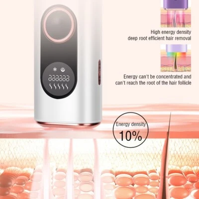 Laser Haarentfernung mit Ice cool schmerzfrei - XOCHS Lumex10 - Bild 1 von 4