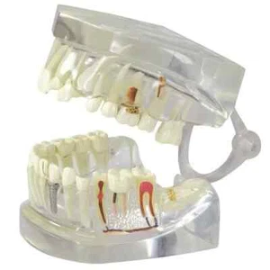 DENTI CHIARI Denti Umani Mascella Modello Anatomico GPI LFA #2861 - SPEDIZIONE GRATUITA!! - Foto 1 di 7