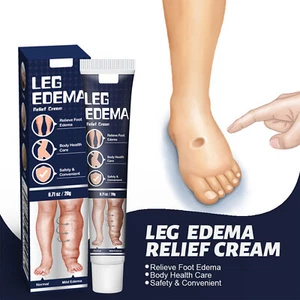 Leg Swelling Anti-Edema Cream Arm Calf Foot Massage Care Plaster Edema Gel Cream - Picture 1 of 10