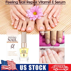 Therapy Vitamin E Peeling Nail Repair Serum,Nail Growth And Strengthening Serum - Picture 1 of 9
