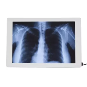 X-ray film viewer X-ray film film viewer LED X-ray film viewer - Picture 1 of 12