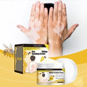 Bienengift-Vitiligo-Beruhigungscreme E4E9 K3A6 F1J8 - Picture 1 of 18