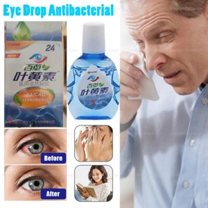 Eye Drops Relieves Eyes Discomfort Blurred Vision Dry Eyes Itchy Eyes Infections - Picture 1 of 9