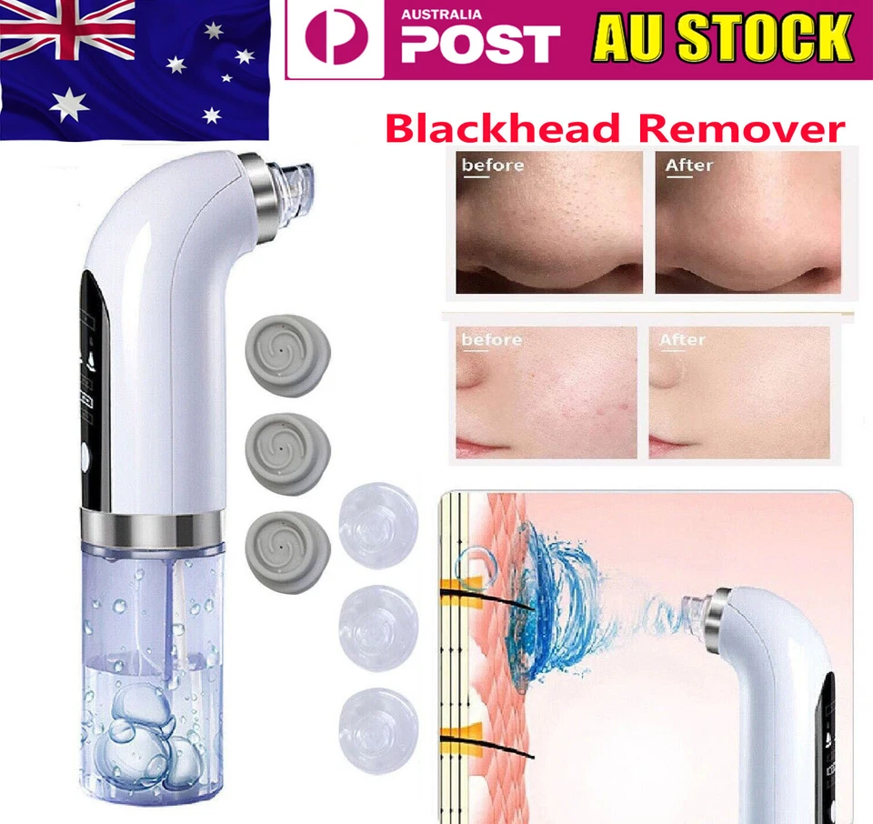 Electric Blackhead Remover Vacuum Pore Face Facial Suction Acne Cleaner Kit - image 1 of 4