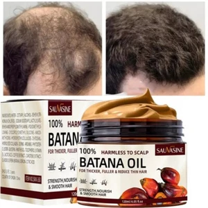 Batana Oil For Hair Growth Hair Loss Treatment Pure Natural Botana Oil, US STOCK - Picture 1 of 24