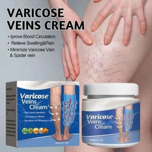 Crema para eliminar venas Cremevital crema varicosas pasta para aliviar venas, mejorar Circu G7J8 63SH - Imagen 1 de 15