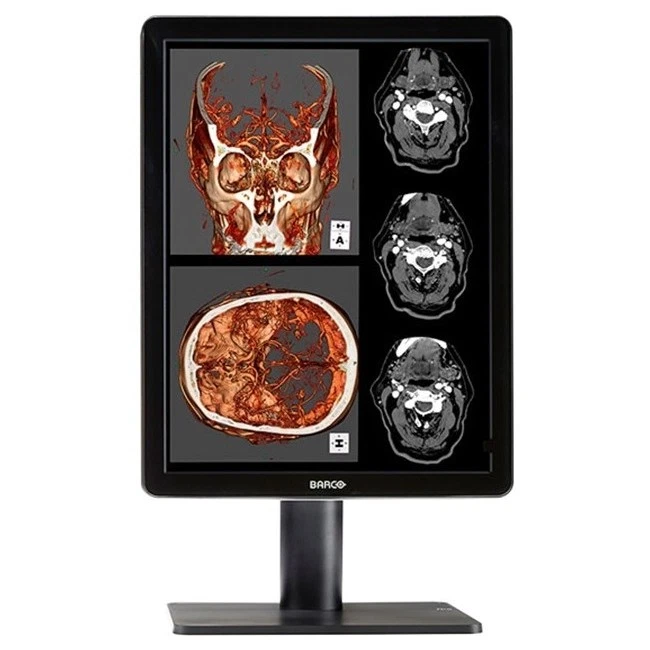 Barco Nio Color MDNC-2221 K9601789 21 inches UXGA LCD Monitor-New Other - Image 1 of 1