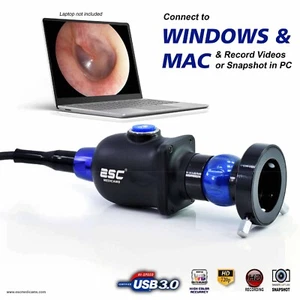 Endoscopy camera HD Portable USB Rigid Endoscope Coupler ENT Medical 1.2MP - Picture 1 of 15