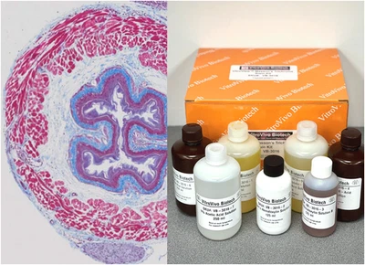 Kit de manchas tricromáticas VitroView™ Masson’s (Cat# VB-3016) Foto 1 de 4