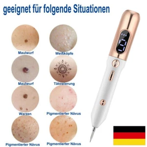 Laser Muttermal Entfernen Stift Plasma Pen Warzen Entfernen Mole Entfernung Pen - Bild 1 von 17