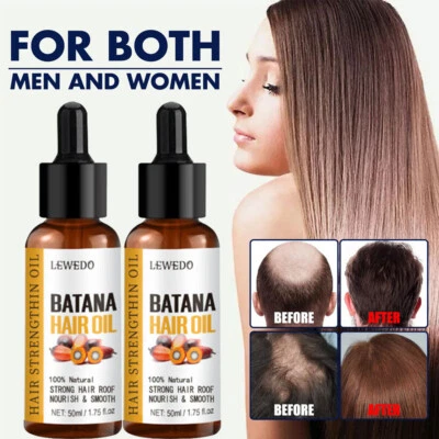 2PACK Batana Oil Serum For Hair Root Repair Damaged Hair Growth Anti Hair Loss - Image 1 of 4