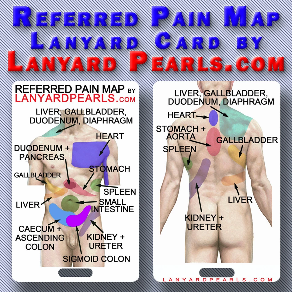 Referred Visceral Pain Map Lanyard Reference Card
