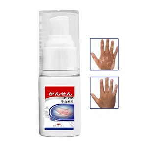 Timilk Viticlea -vitiligo -spray, Vitiligobehandle, Vitiligo -bhandleungscreme - Bild 1 von 9
