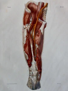 1850 Anatomy Surgery Arteries Thigh Front View Adult Jacob Lithograph - Picture 1 of 5