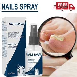 Blinzador Nails Spray Fingernägel Ernährung Langanhaltende Zehennagelpflege Zubehör - Bild 1 von 9