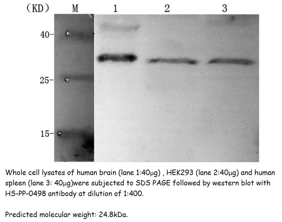 兔子抗人类 GH1 多克隆抗体,100uL,www.sunnybiotechnology.com  — 第 1/1 张图片
