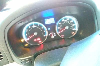 2010 Accent OE Speedometer Gauge Cluster 95K Miles Hyundai - Image 1 of 4