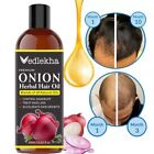 Vedlekha Ayurveda Premium Onion Hair Oil Hair Growth & Hair Fall Control 60ML