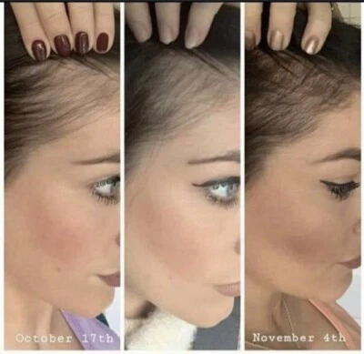 Rejuvenation AgeLoc Shampoo and Conditioner Set for Thinning Hair/Loss - Image 1 of 2