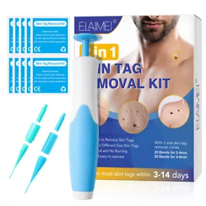 2 in 1 Auto Micro Skin Tag Remover Device Kit Safe Painless Removal 2-8 mm Tool - Picture 1 of 7